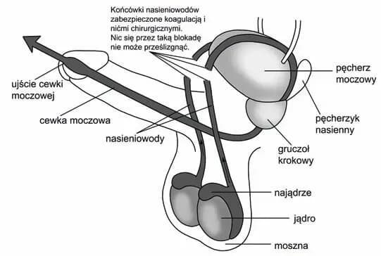 Czy wazektomia to grzech? Zrozumienie nauki Kościoła katolickiego